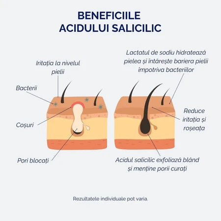 Ser cu acid salicilic 2%, pentru tenul sensibil și acneic, 30 ml, Meloni