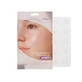 Ultra-thin hydrocolloidal anti-acne patches with onion extract, 15 pieces, Isntree