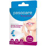 Pasocare Specialist Plus, patches for herpes, 14 mm, 10 pcs.