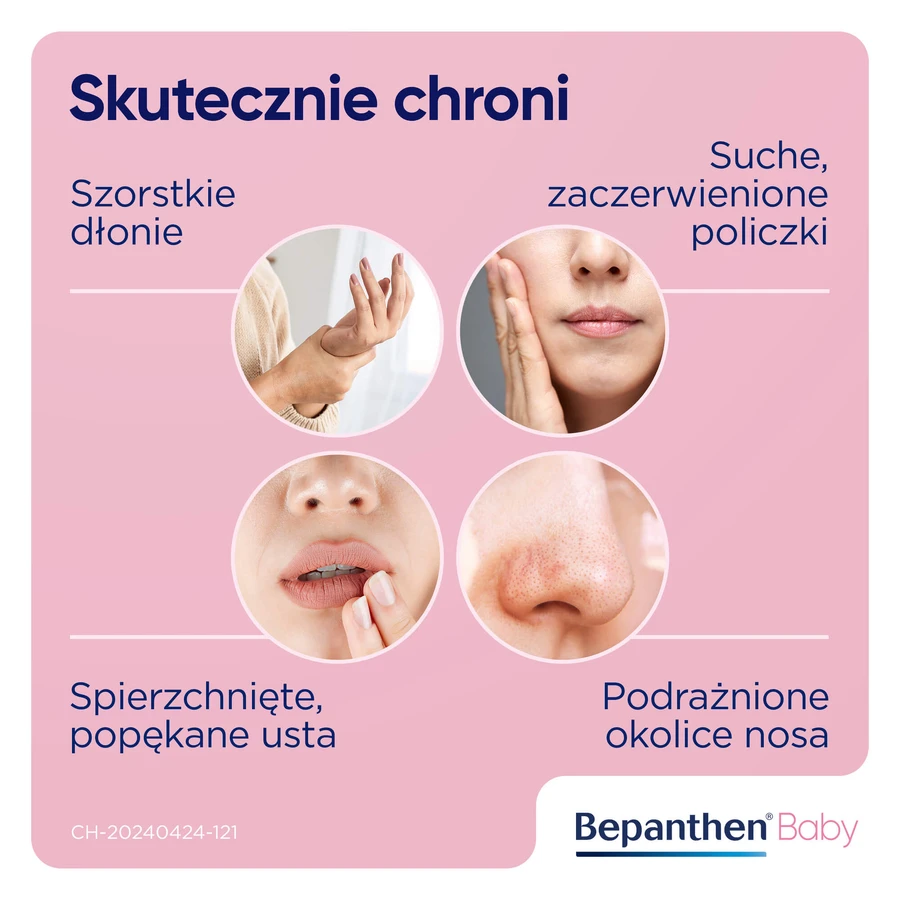 Bepanthen Baby, luieruitslagzalf voor baby's, 30 g VERONTREINIGDE VERPAKKING