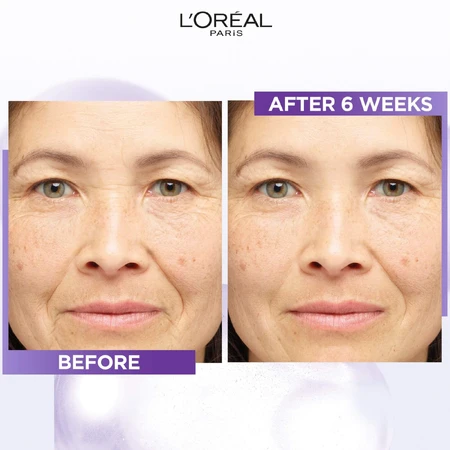 L'Oréal Paris Revitalift Filler Ser antirid cu 1,5% acid hialuronic pur 30 ml