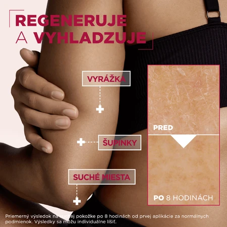 Mixa Urea Cica Repair+ Regenerationspflege für sehr trockene und raue Haut, 400 ml