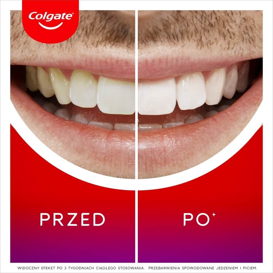 Colgate Max White Overnight, Aufhellungsapplikator, 2,5 ml