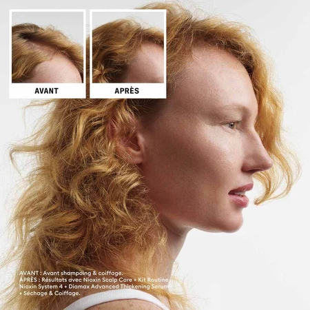 Nioxin System 4 Kit für coloriertes/trockenes/geschädigtes Haar und fortgeschrittenen Haarausfall 700ml