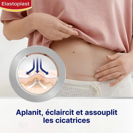 Elastoplast Scar Reducer x21