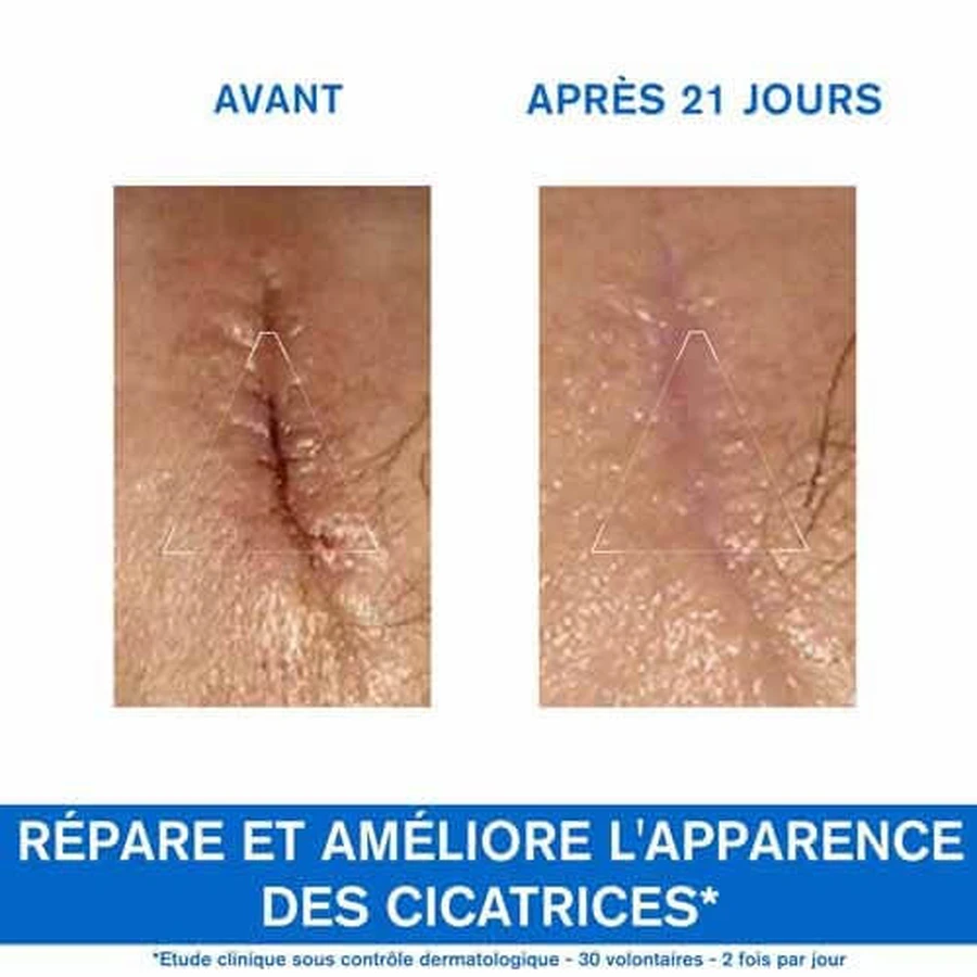 Uriage Bariéderm-Cica Repair Cream With Cu-zn Bariederm Irritated Skin Peaux Fragilisees 100ml