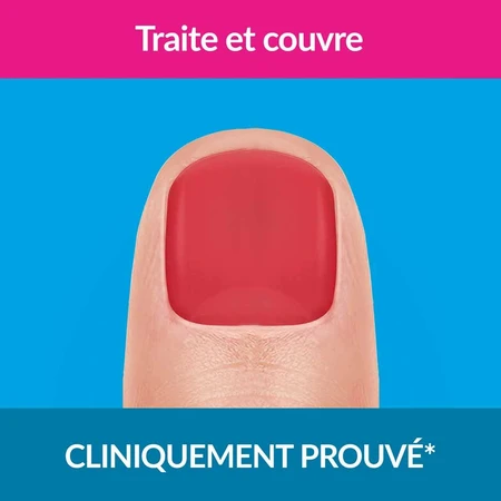 Excilor Nail Fungus Treatment Strong Coral Red Coloration 30ml