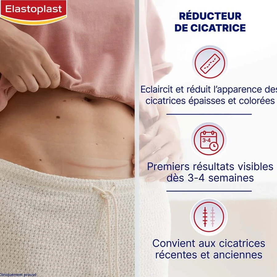 Elastoplast Dressings Narbenreduzierer Größe XL 21 Pflaster