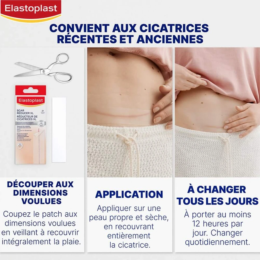 Elastoplast Dressings Narbenreduzierer Größe XL 21 Pflaster