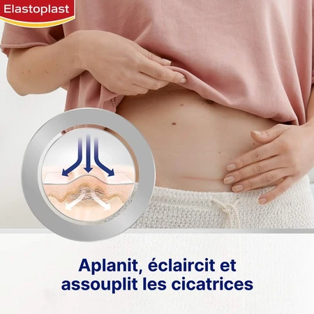 Elastoplast Dressings Narbenreduzierer Größe XL 21 Pflaster