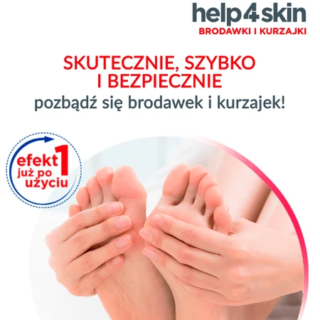 Help4Skin Warts and Warts, aerosol, 50 ml