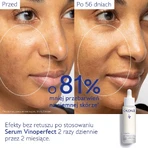 Caudalie Vinoperfect serum, brightening hyperpigmentation, 50 ml