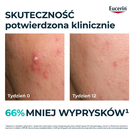 Eucerin DermoPure Clinical Triple Action, sérum de triple acción para pieles grasas y con tendencia acneica, 40 ml