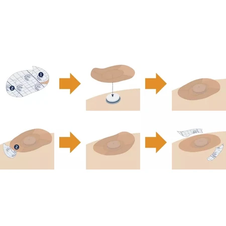 Plasturi cu senzor CureTape, plasturi cu senzor CGM pentru monitorizarea glucozei, bej, 25 bucăți