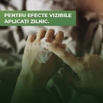 Cremă antimicotică pentru ciuperca unghiei Micotic Protect, 70 ml, Colț de Sănătate