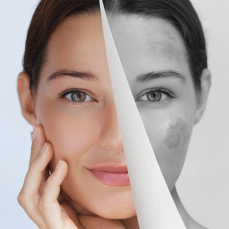 Miraculum Anti-Pigmentare, cremă de mâini pentru corectarea imperfecțiunilor, 75 ml