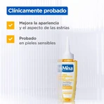 Mixa Aceite antiestrías contra los signos del embarazo o los cambios de peso 100 ml