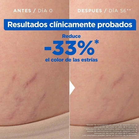 Mixa Aceite antiestrías contra los signos del embarazo o los cambios de peso 100 ml