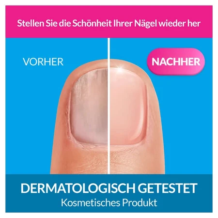 Excilor Regenererend Nagelserum 10 ml