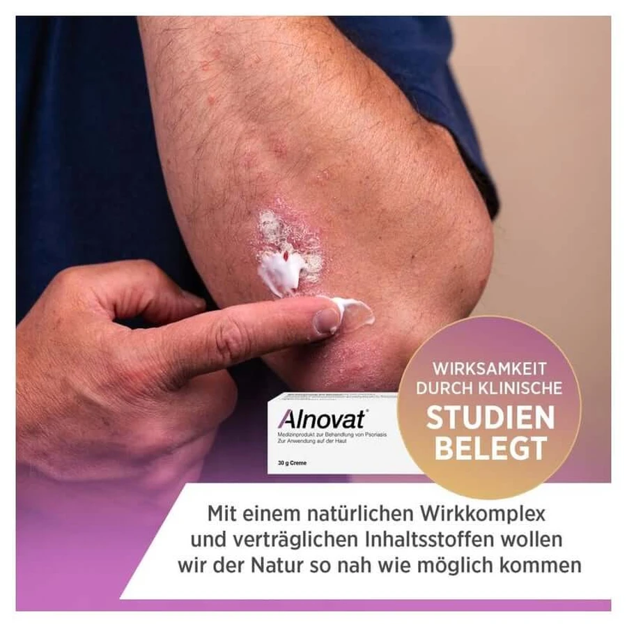 ALNOVAT Crema 50 g