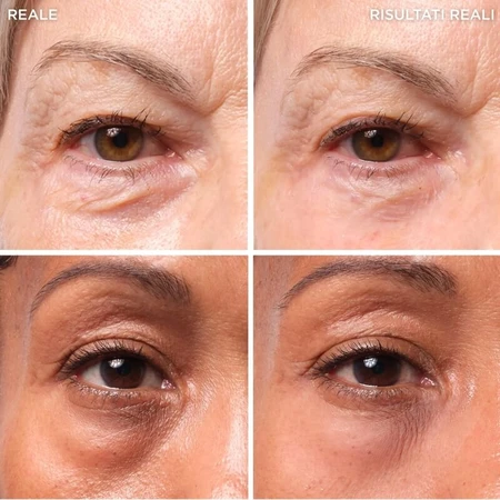 It Cosmetics Bye Bye Under Eye Bag – Augencreme 15 ml