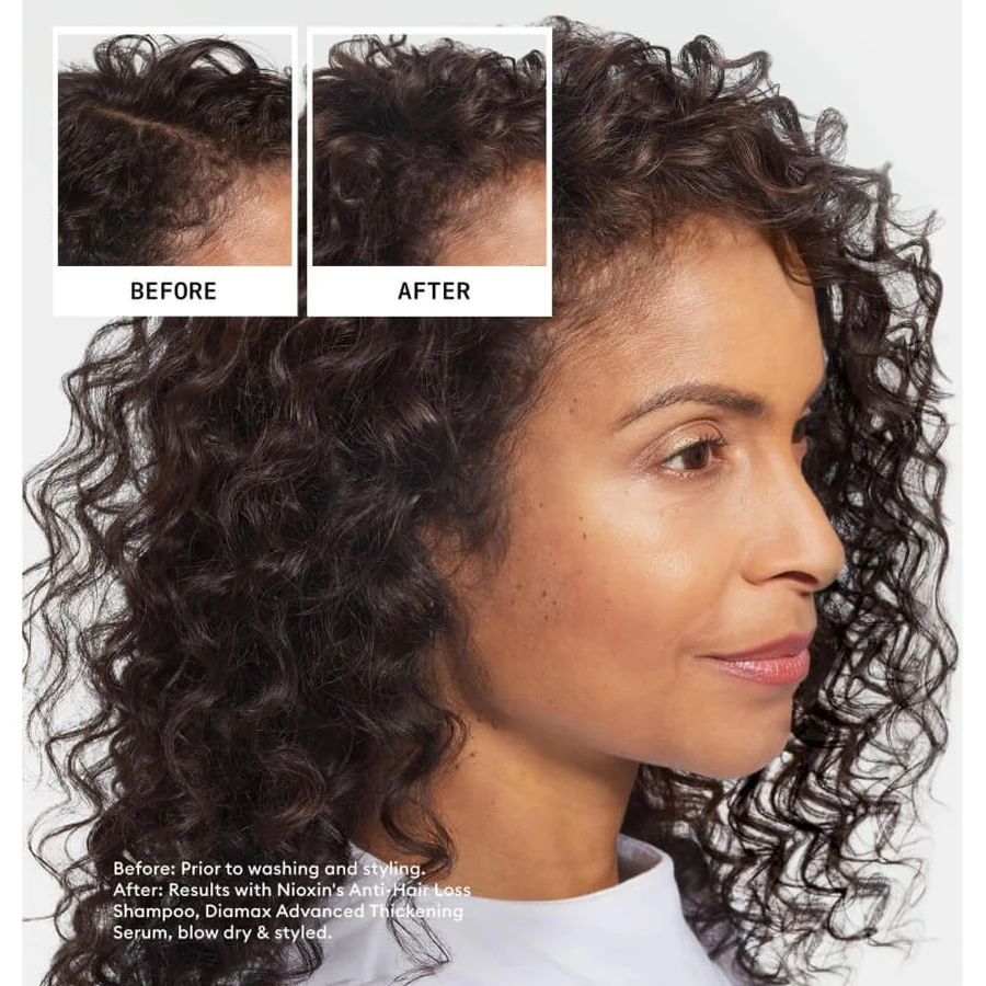 Nioxin gegen Haarausfall – Shampoo gegen Haarausfall 240 ml