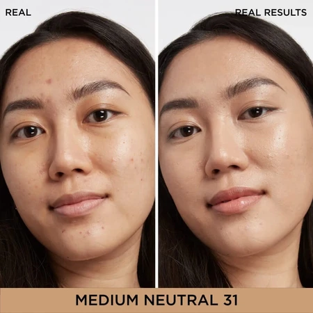 It Cosmetics Bye Bye Dark Spots – Concealer + Serum Nr. 31 Medium Neutral